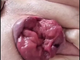 脱肛玩弄 porn gay chinese clover
